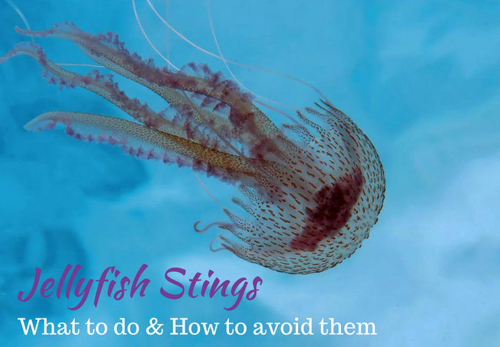 Jellyfish stings - How to treat them